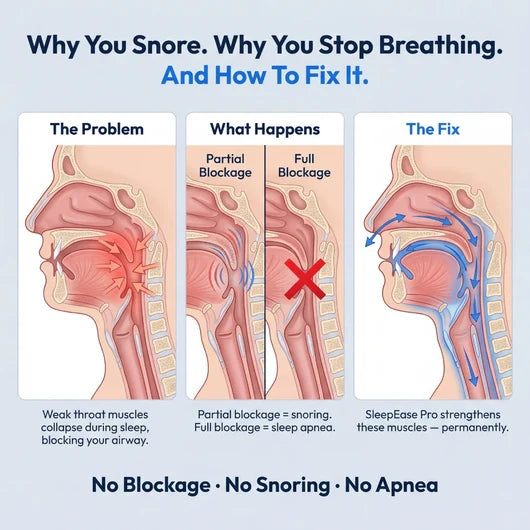 SleepEase Pro — Eliminates Snoring &amp; Sleep Apnea