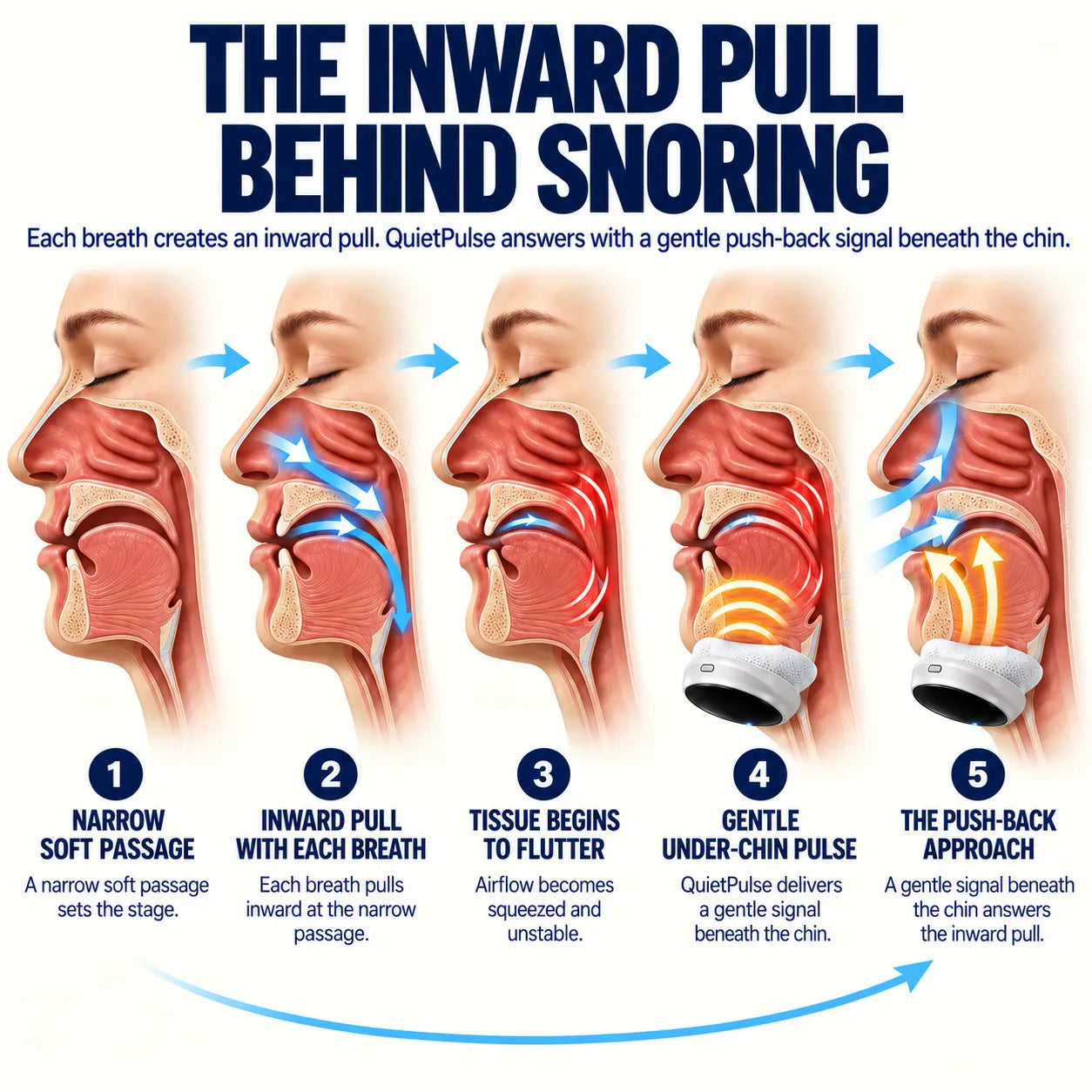 QuietPulse Anti-Snoring Device – Built for Where the Snore Starts